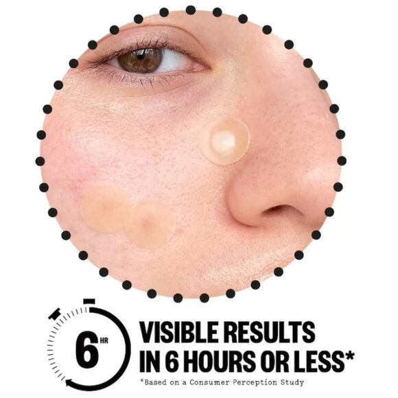 NWT 2-Pack Peace Out  Salicylic Acid Acne Day Dots - Picture 4 of 7